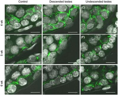 What do we know about blood-testis barrier? current understanding of its structure and physiology